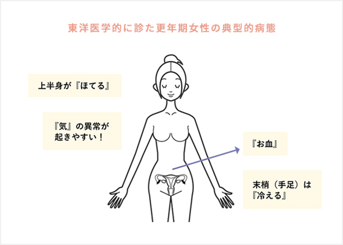 【中古】 女性の病気を治す漢方療法 更年期障害治療における漢方療法・漢方薬について ｜ 埼玉県・東京都の